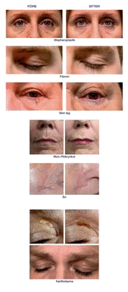 jettplasma gruppbild